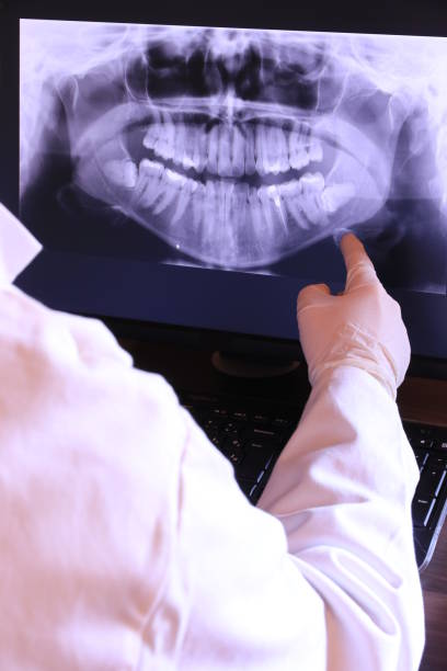Best Emergency Root Canal Treatment in Wilmer, TX