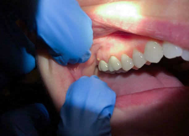 Best Emergency Dental Services for Seniors in Wilmer, TX