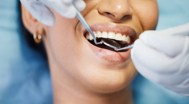 Best Emergency Dentist for Knocked-Out Tooth in Wilmer, TX